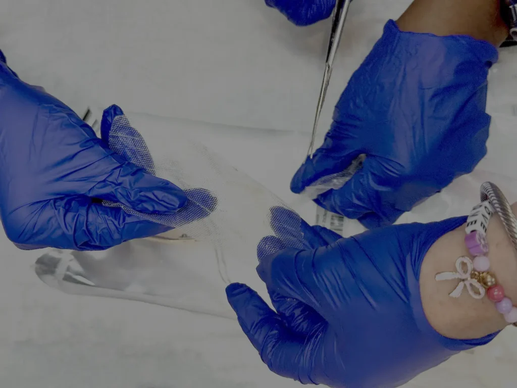 Wound care nurses cut out a skin substitute placental graft for a chronic wound.