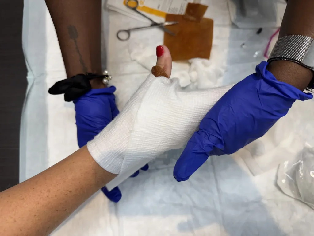 A proper dressing is required to heal a chronic wound.